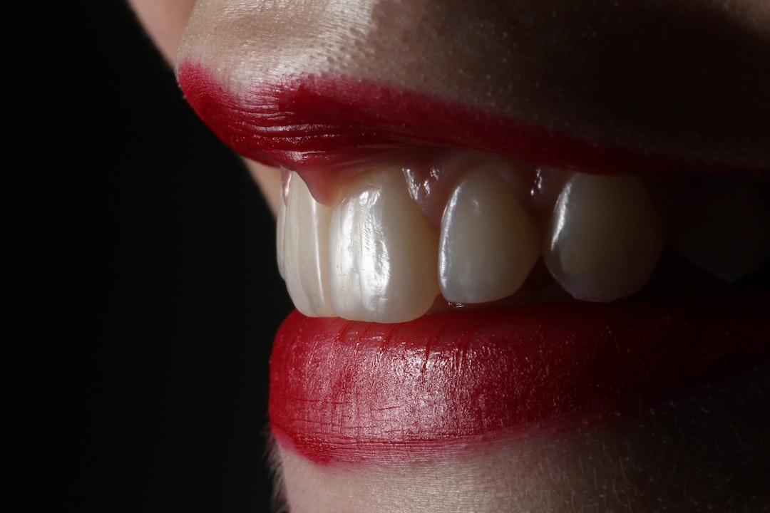 İnvisalign Tedavisi