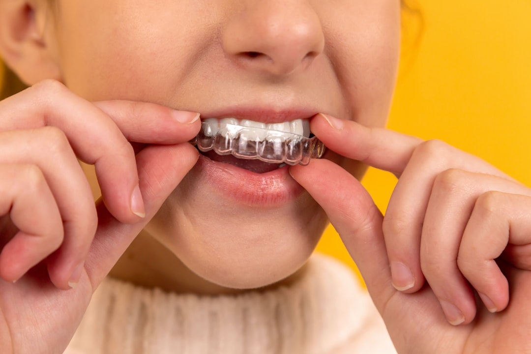 İnvisalign plakları nasıl uygulanır?