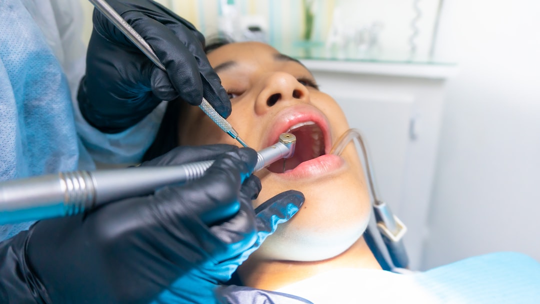İnvisalign tedavisi sırasında diş dolgusu yapılır mı?